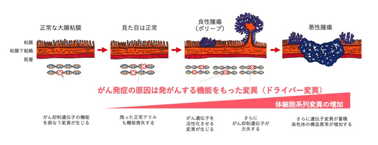図1. がんの発症メカニズムの例